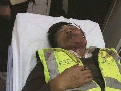 環衛工人險撞狗被打頭破血流 頭部疾病如何預防 
