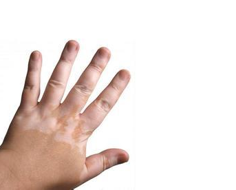 png QQ图片20161020144836.png