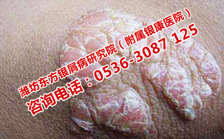 jpg yxb (5).jpg