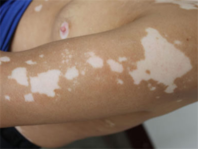 png 1-1403221J93N13.png