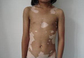 png QQ截图20161104152348.png