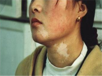 png QQ截图20161029200838.png