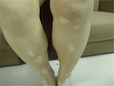 jpg 5-1504251G533531.jpg