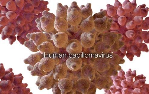 宫颈癌首要致病因素：HPV（人乳头瘤病毒）