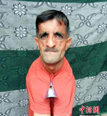 國外橡皮人可折疊身體 雙肩折斷60張CD破紀錄