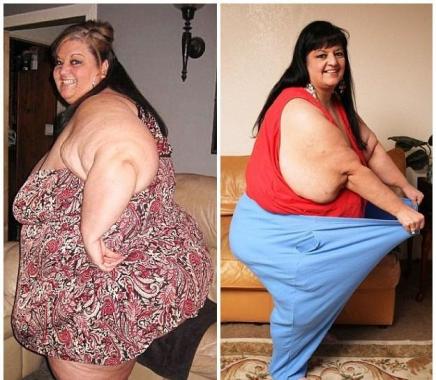 女子为迎合男友癖好暴食 体重达654斤