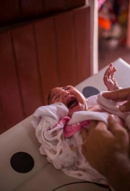 巴西“小头症”女婴庆祝四月大生日