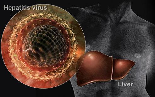 什么是肝炎