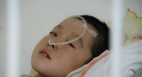 脑炎有什么后遗症 脑炎有什么后遗症