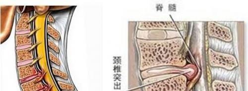 中医 中医常识 五,膀胱功能在不同时期的脊髓损伤中可出现不同类型的