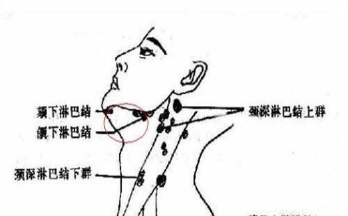 警惕:身體不痛不癢也患癌(5)