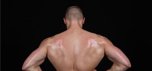 肌萎缩性侧索硬化症 肌萎缩性侧索硬化症