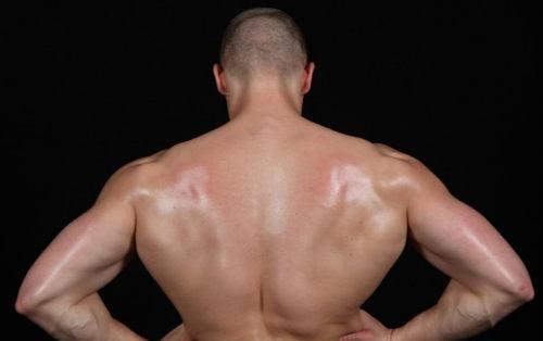 男性念珠菌感染 男性念珠菌感染