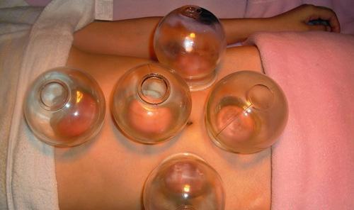 了解拔罐拔出水泡的真正原因 了解拔罐拔出水泡的真正原因(2)
