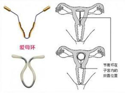 两性