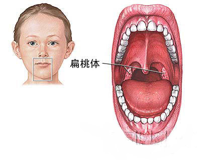 咽扁桃体位置图片图片