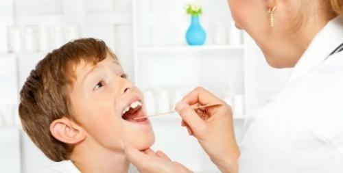 毒性咽喉炎的预防方法