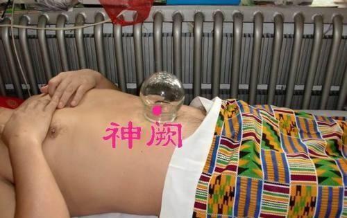 艾灸养生的八大穴位(1)