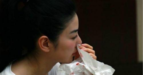 鼻出血的介绍及处理方法