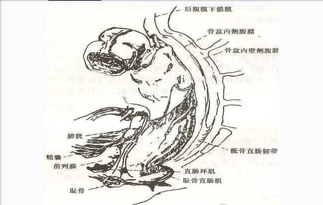 直肠解剖图